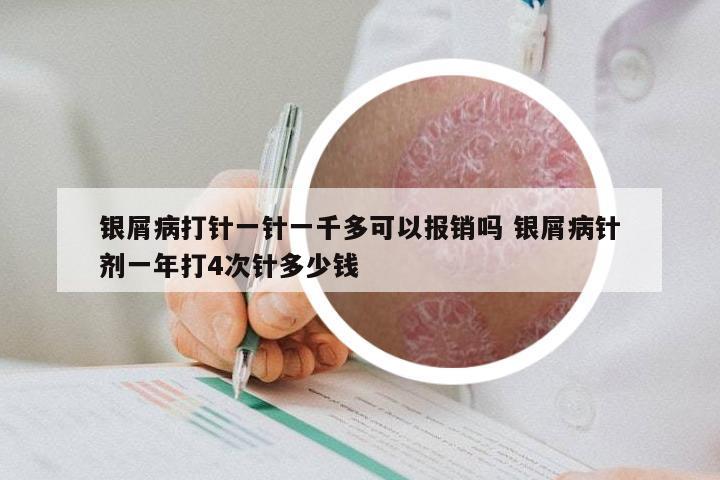 银屑病打针一针一千多可以报销吗 银屑病针剂一年打4次针多少钱