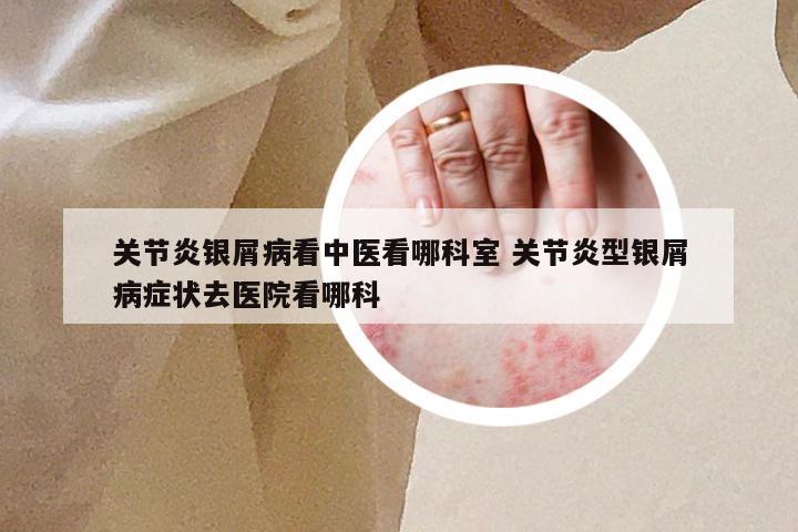 关节炎银屑病看中医看哪科室 关节炎型银屑病症状去医院看哪科