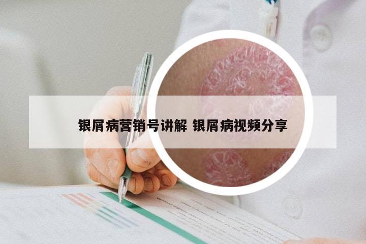 银屑病营销号讲解 银屑病视频分享