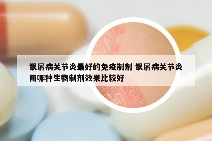 银屑病关节炎最好的免疫制剂 银屑病关节炎用哪种生物制剂效果比较好
