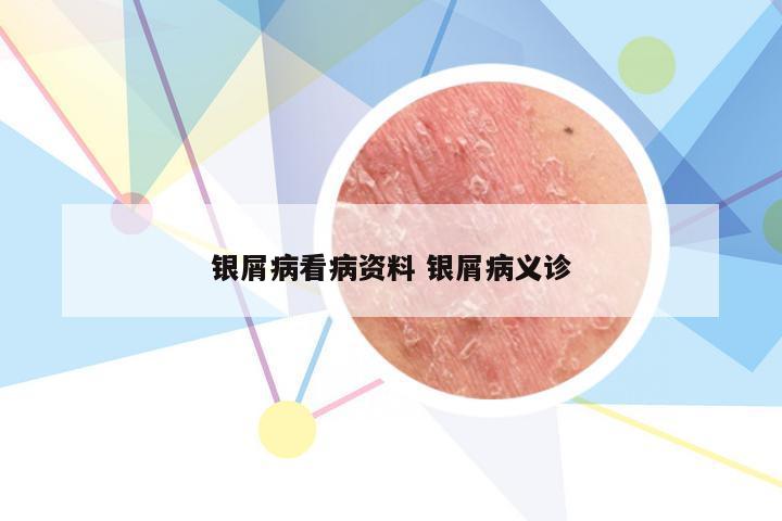 银屑病看病资料 银屑病义诊
