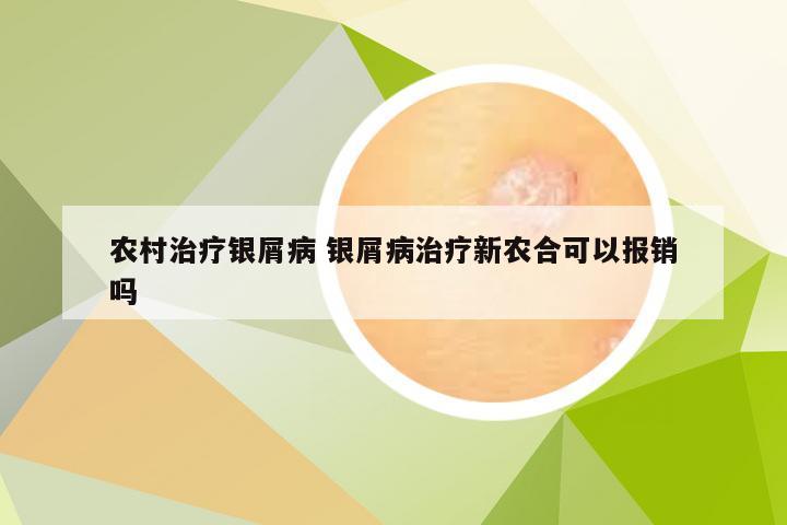 农村治疗银屑病 银屑病治疗新农合可以报销吗