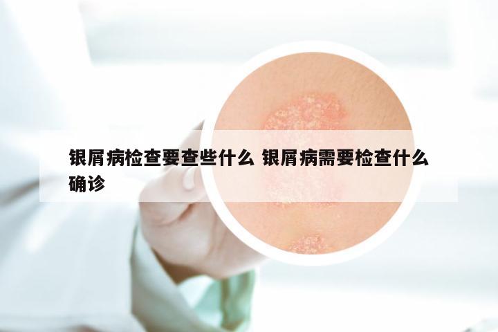 银屑病检查要查些什么 银屑病需要检查什么确诊
