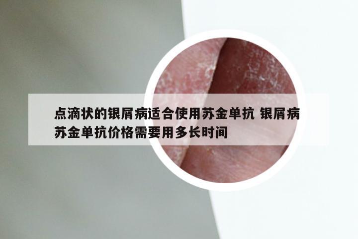 点滴状的银屑病适合使用苏金单抗 银屑病 苏金单抗价格需要用多长时间