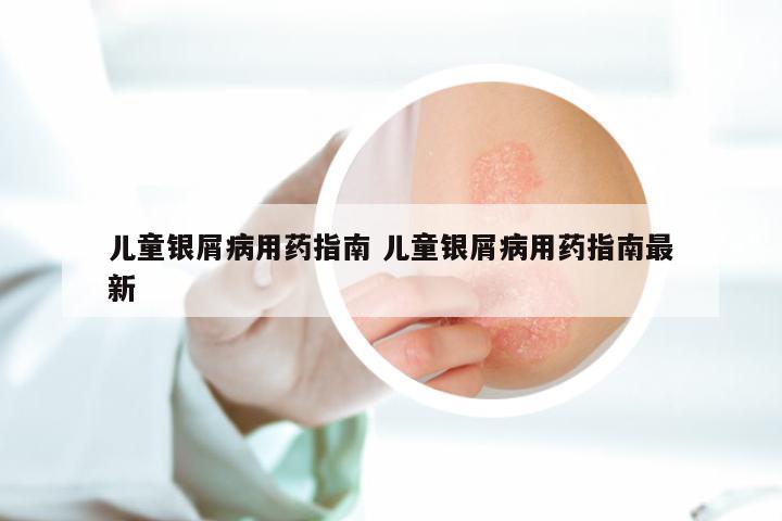 儿童银屑病用药指南 儿童银屑病用药指南最新