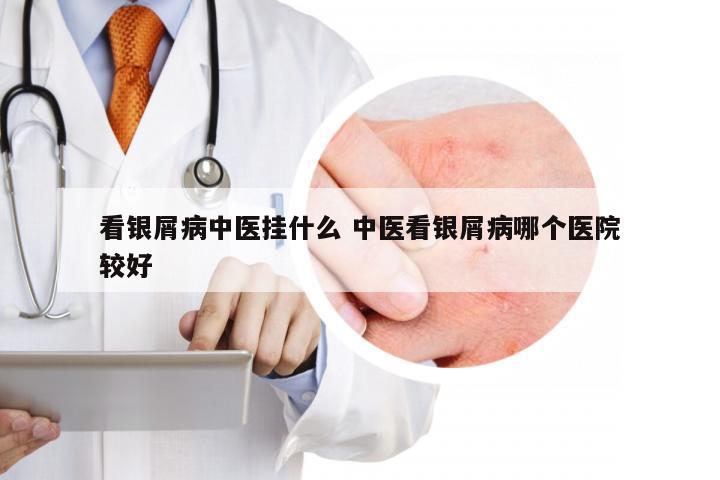 看银屑病中医挂什么 中医看银屑病哪个医院较好