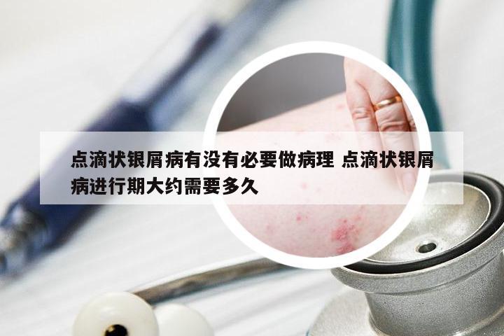 点滴状银屑病有没有必要做病理 点滴状银屑病进行期大约需要多久