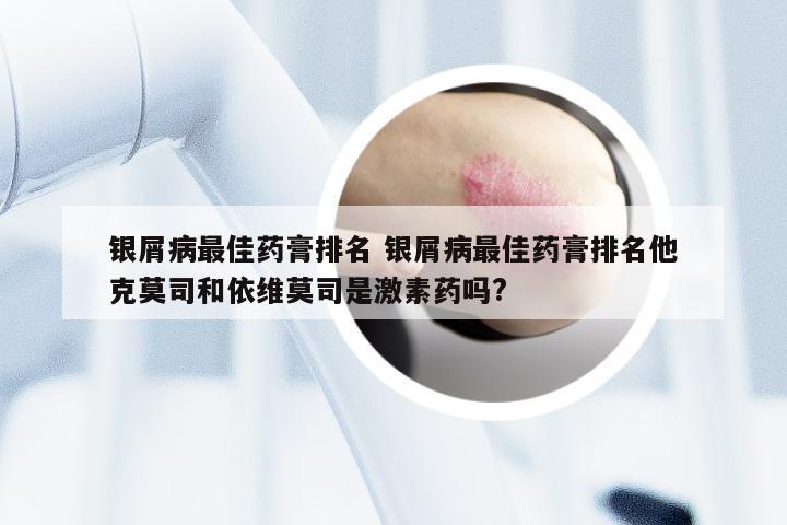 银屑病最佳药膏排名 银屑病最佳药膏排名他克莫司和依维莫司是激素药吗?