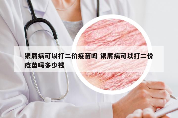 银屑病可以打二价疫苗吗 银屑病可以打二价疫苗吗多少钱
