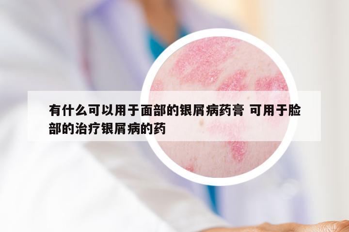 有什么可以用于面部的银屑病药膏 可用于脸部的治疗银屑病的药