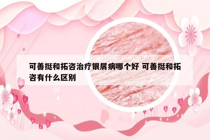 可善挺和拓咨治疗银屑病哪个好 可善挺和拓咨有什么区别