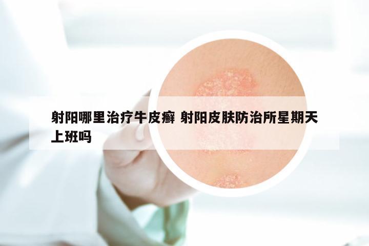 射阳哪里治疗牛皮癣 射阳皮肤防治所星期天上班吗