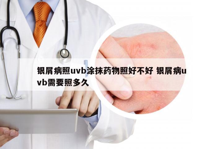 银屑病照uvb涂抹药物照好不好 银屑病uvb需要照多久