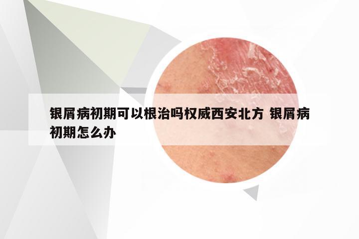 银屑病初期可以根治吗权威西安北方 银屑病初期怎么办