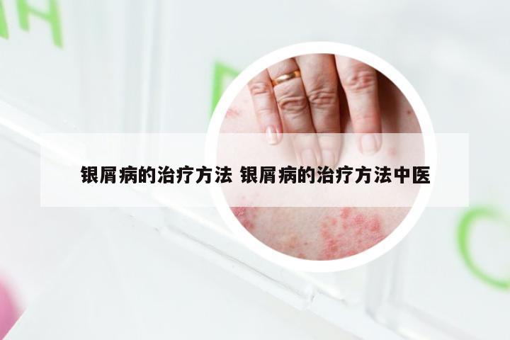 银屑病的治疗方法 银屑病的治疗方法中医