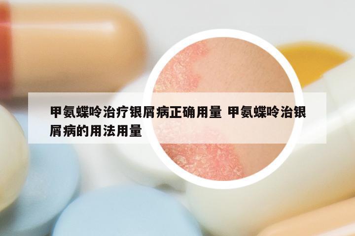 甲氨蝶呤治疗银屑病正确用量 甲氨蝶呤治银屑病的用法用量