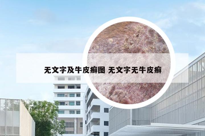 无文字及牛皮癣图 无文字无牛皮癣
