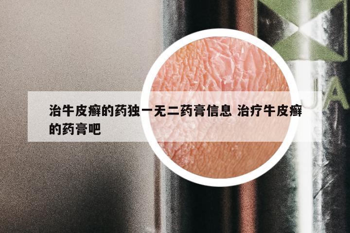 治牛皮癣的药独一无二药膏信息 治疗牛皮癣的药膏吧