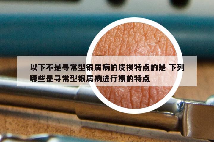 以下不是寻常型银屑病的皮损特点的是 下列哪些是寻常型银屑病进行期的特点