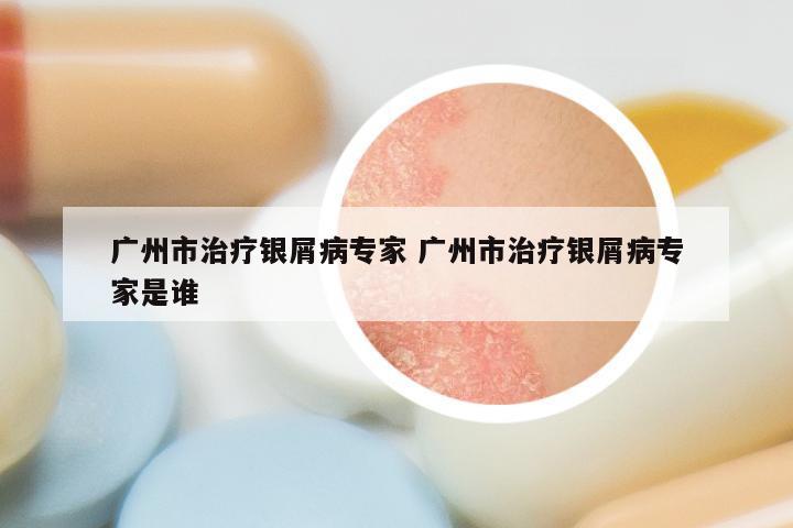 广州市治疗银屑病专家 广州市治疗银屑病专家是谁