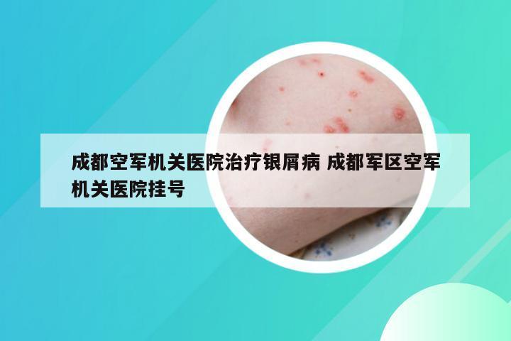成都空军机关医院治疗银屑病 成都军区空军机关医院挂号