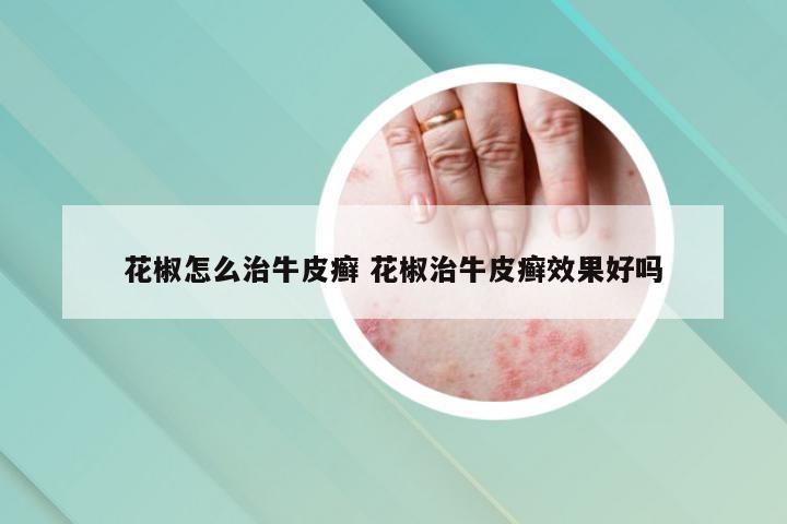 花椒怎么治牛皮癣 花椒治牛皮癣效果好吗