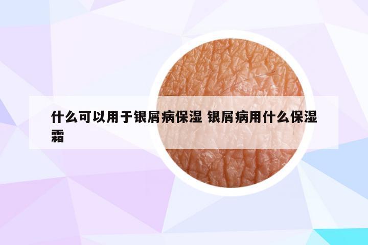 什么可以用于银屑病保湿 银屑病用什么保湿霜