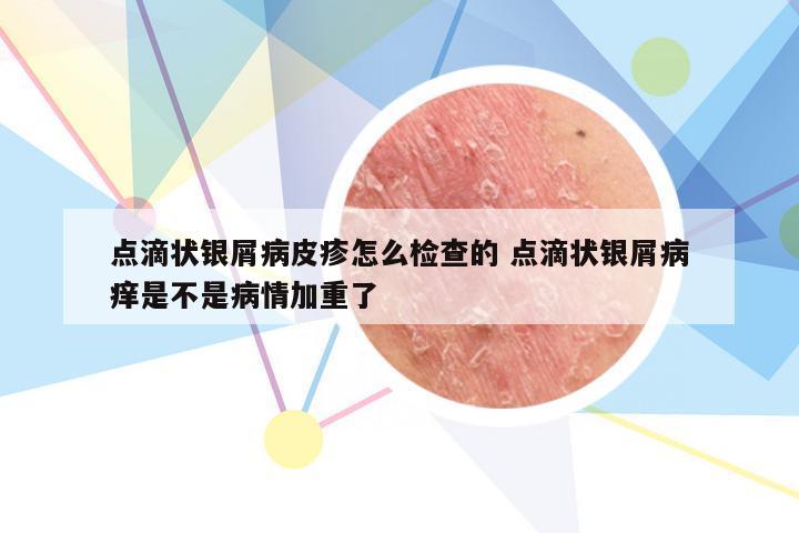 点滴状银屑病皮疹怎么检查的 点滴状银屑病痒是不是病情加重了