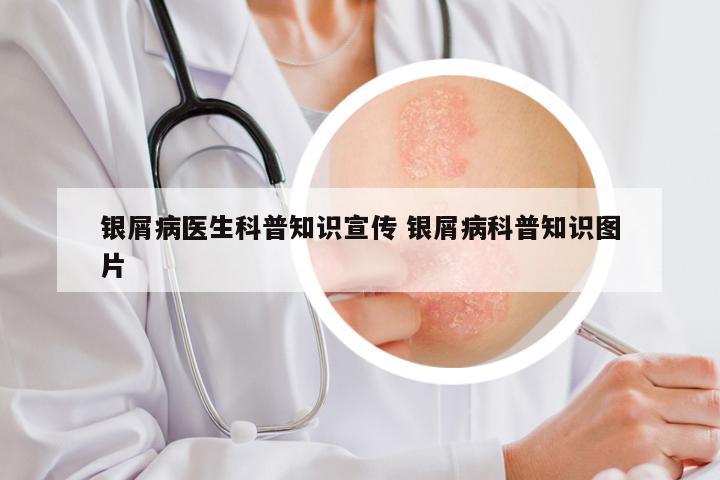 银屑病医生科普知识宣传 银屑病科普知识图片