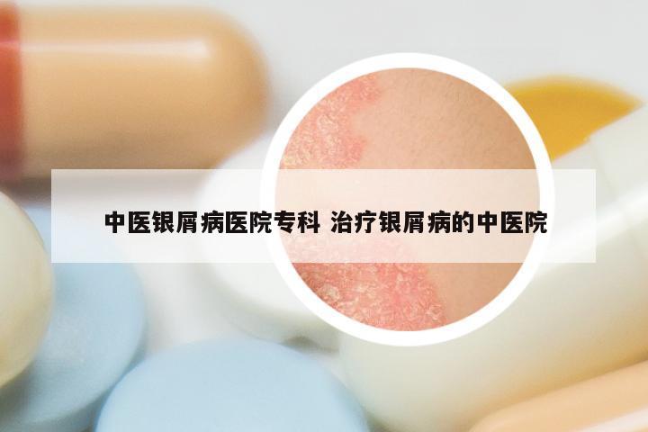 中医银屑病医院专科 治疗银屑病的中医院