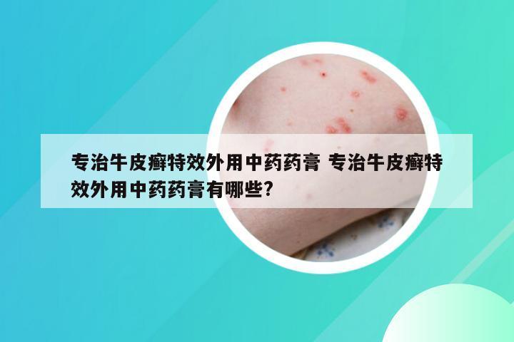专治牛皮癣特效外用中药药膏 专治牛皮癣特效外用中药药膏有哪些?