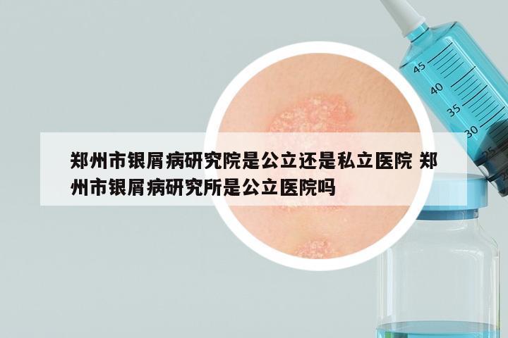 郑州市银屑病研究院是公立还是私立医院 郑州市银屑病研究所是公立医院吗