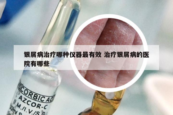 银屑病治疗哪种仪器最有效 治疗银屑病的医院有哪些