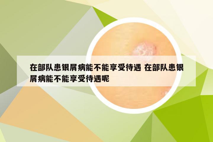 在部队患银屑病能不能享受待遇 在部队患银屑病能不能享受待遇呢