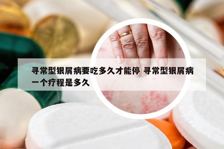 寻常型银屑病要吃多久才能停 寻常型银屑病一个疗程是多久