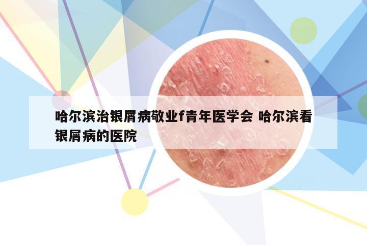 哈尔滨治银屑病敬业f青年医学会 哈尔滨看银屑病的医院