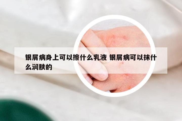 银屑病身上可以擦什么乳液 银屑病可以抹什么润肤的