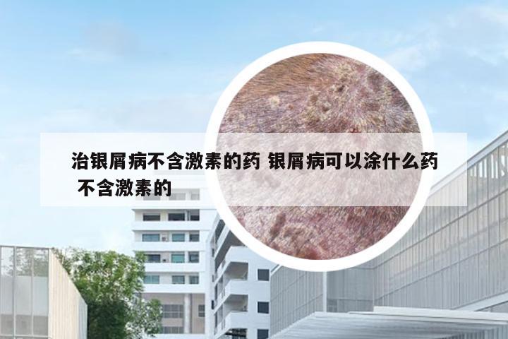 治银屑病不含激素的药 银屑病可以涂什么药 不含激素的