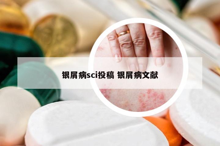 银屑病sci投稿 银屑病文献