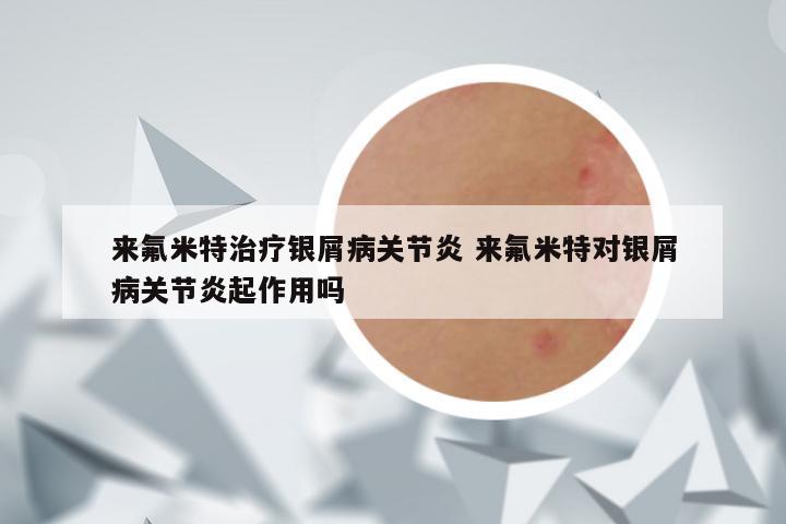 来氟米特治疗银屑病关节炎 来氟米特对银屑病关节炎起作用吗