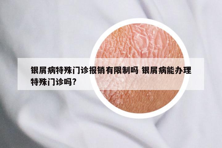 银屑病特殊门诊报销有限制吗 银屑病能办理特殊门诊吗?