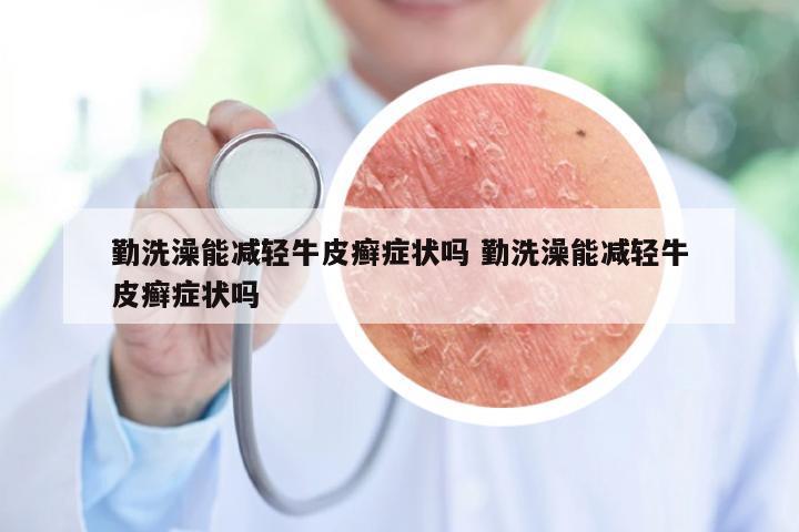 勤洗澡能减轻牛皮癣症状吗 勤洗澡能减轻牛皮癣症状吗