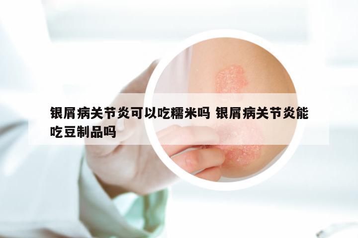 银屑病关节炎可以吃糯米吗 银屑病关节炎能吃豆制品吗