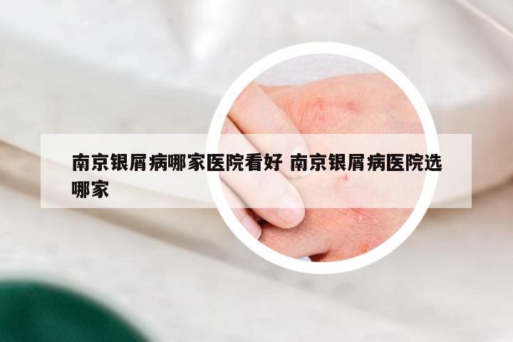 南京银屑病哪家医院看好 南京银屑病医院选哪家