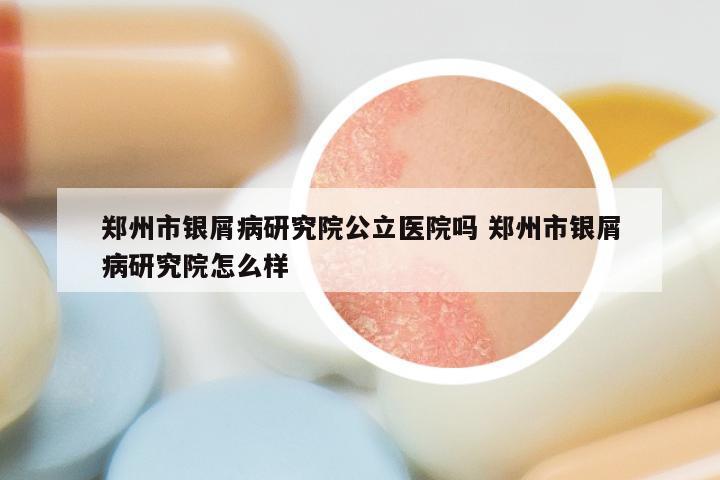 郑州市银屑病研究院公立医院吗 郑州市银屑病研究院怎么样