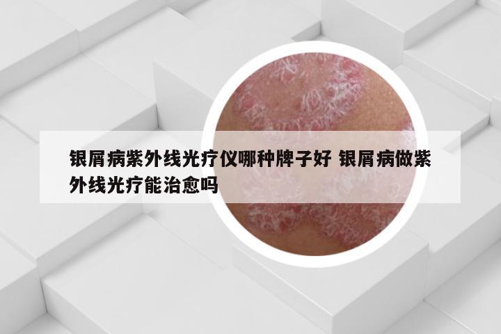 银屑病紫外线光疗仪哪种牌子好 银屑病做紫外线光疗能治愈吗