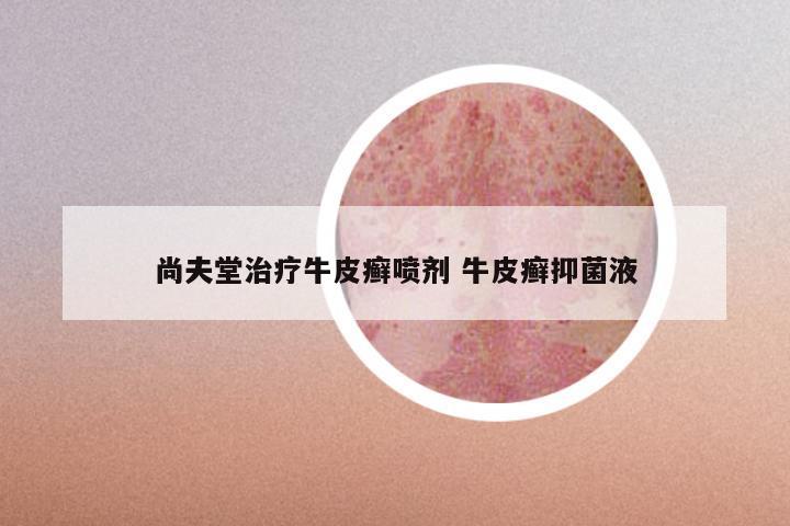 尚夫堂治疗牛皮癣喷剂 牛皮癣抑菌液