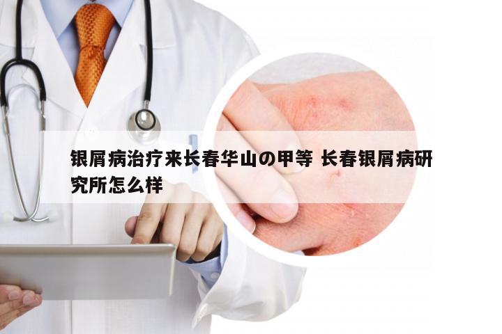 银屑病治疗来长春华山の甲等 长春银屑病研究所怎么样