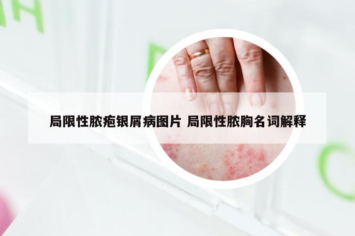 局限性脓疱银屑病图片 局限性脓胸名词解释