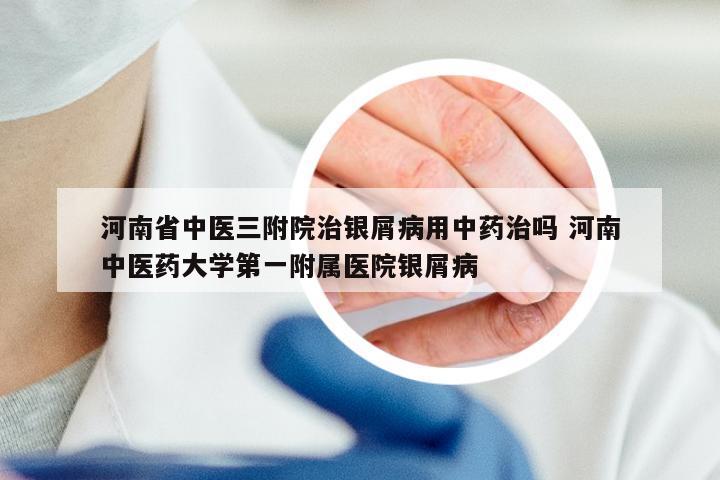 河南省中医三附院治银屑病用中药治吗 河南中医药大学第一附属医院银屑病